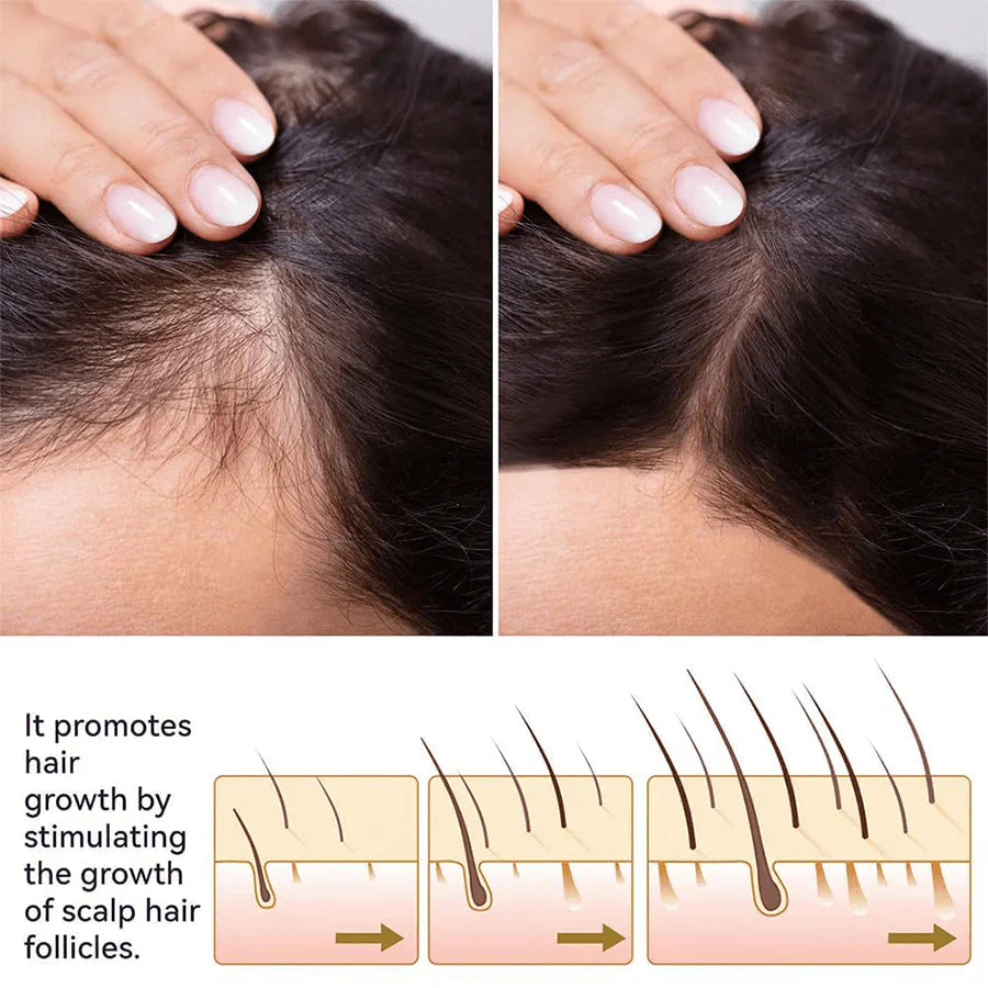 FEG Plus Hair Growth Spray - 100% Original - For Men & Women